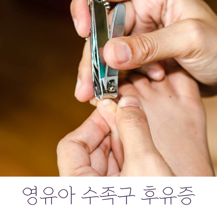 영유아 수족구 후유증 손발톱 빠짐?