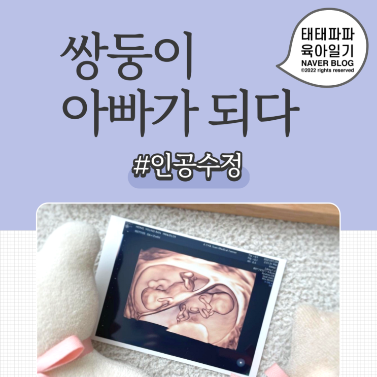  남매둥이의 아빠가 되다. (인공수정, 쌍둥이 초음파 사진)