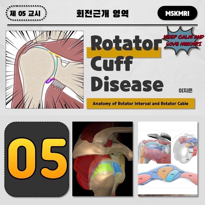  [Rotator cuff Anatomy 05] Anatomy of Rotator Interval and Rotator Cable