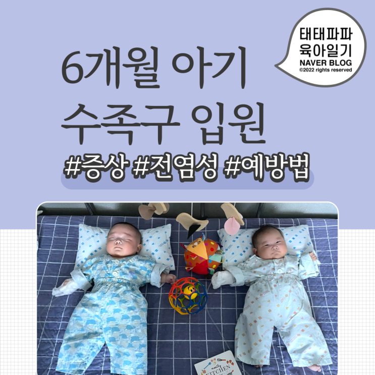  아기 수족구, 생후 6개월 남매쌍둥이 입원