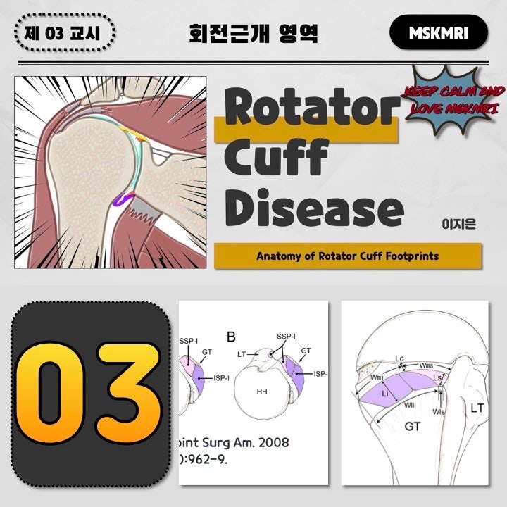  [Rotator cuff Anatomy 03] Anatomy of Rotator Cuff Footprints, 회전근개, shoulder MRI, supraspinatus, 동영상
