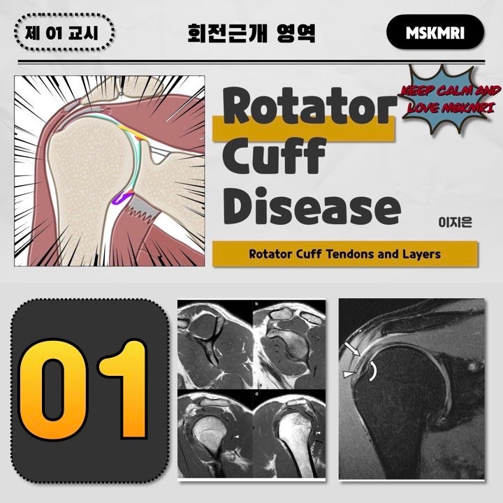  [Rotator cuff_Anatomy_01] Rotator cuff Tendons and Layers