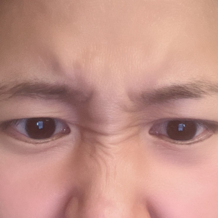  미간주름 마르시끄 미간패치로 방지