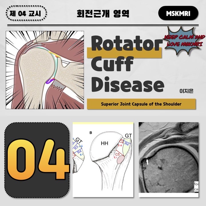  [Rotator cuff Anatomy 04] Superior Joint Capsule of the Shoulder
