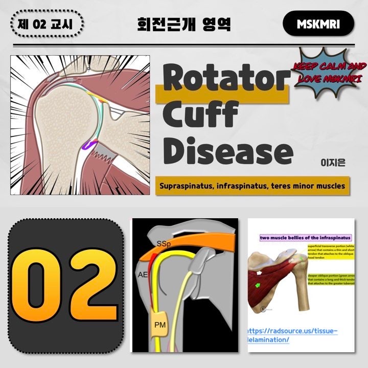  [Rotator cuff Anatomy 02] Supraspinatus, infraspinatus, teres minor muscles