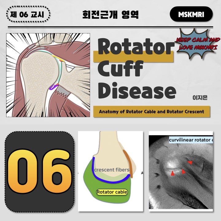  [Rotator cuff Anatomy 06] Anatomy of Rotator Cable and Rotator Crescent