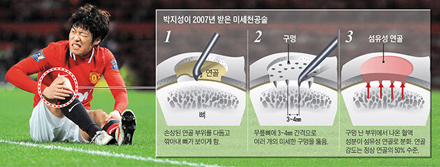  손목 부상 때문에 MRI 찍고 온 후기 - 내 연골 멀쩡하니?