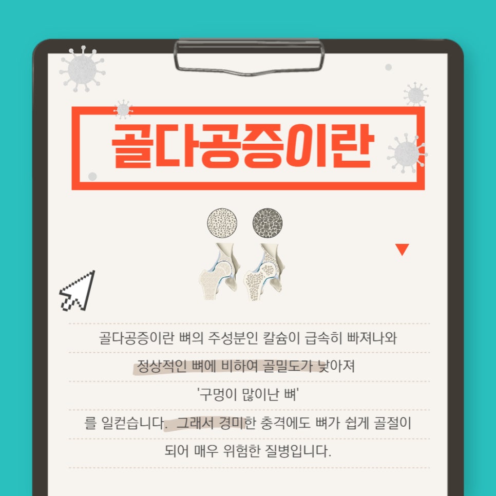 골다공증 원스탑 진료! — 본문 그림