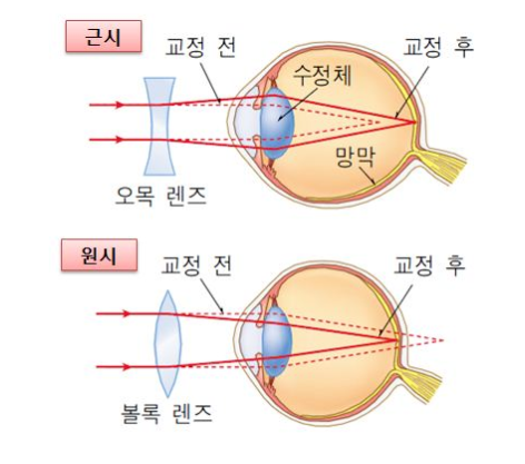  안경처방전 도대체 어떻게 읽는 거에요?