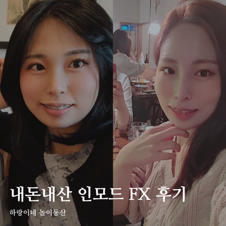  내돈내산 신부관리 인모드 FX 가격 이중턱 리프팅 통증