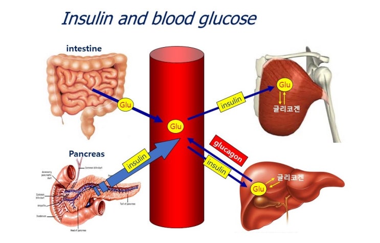  당뇨병이란? 인슐린저항성과 합병증, 당화혈색소(HbA1c), 운동과 당수송단백체(GLUT4)