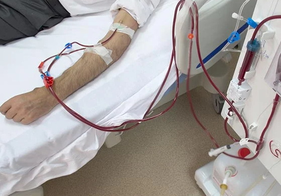 송파 인근 신장투석이 가능한 병원의 만성 신부전 관리를 위해