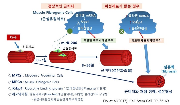  노화(aging), 운동중지(detraining)에 따른 근위축(muscle atrophy, disuse atrophy)과 근섬유화(fibrosis) 기전