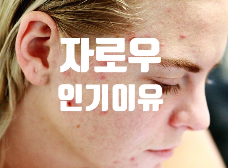자로우 판토텐산, 부작용, 효능, 복용법 가성비 좋음