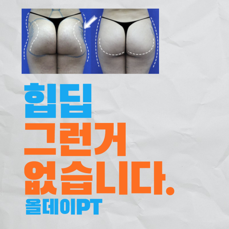  까치산PT 올데이 운동칼럼 / 힙딥의 원인은 잘못된 운동? 아닙니다!
