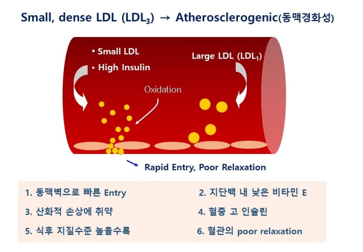  동맥경화(Arteriosclerosis)와 저밀도지단백질(LDL3, LDL1), 그리고 고콜레스테롤혈증(Hypercholesterolemia)