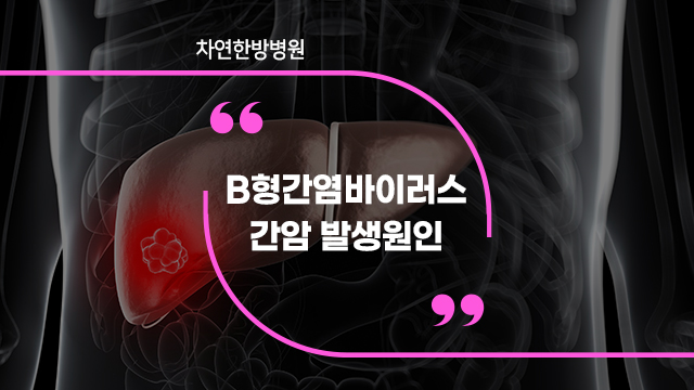  B형간염바이러스 간암 발생 위험비율 높아