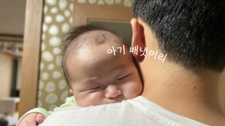 신생아 아기 배냇머리 빠짐 언제까지? : 두피각질 제거방법