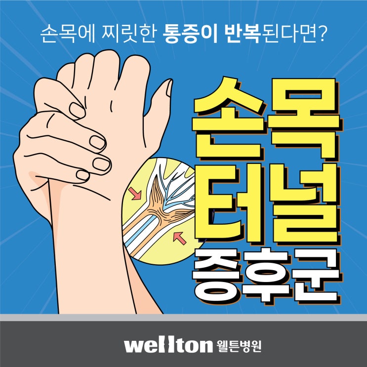  강서구손목통증 간단한 예방운동법 소개