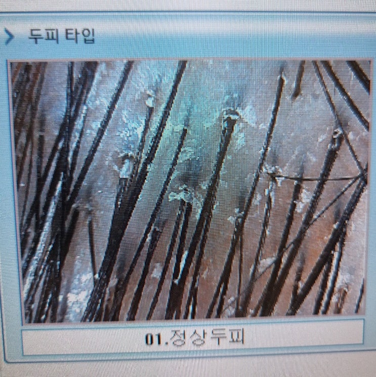 동탄두피관리 매력속으로!  모두모두안녕 두피관리실 짱좋아~