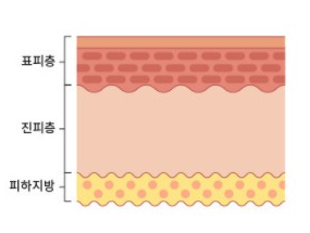  세라마이드 충전-세라티크. 노화방지, 피부장벽 강화