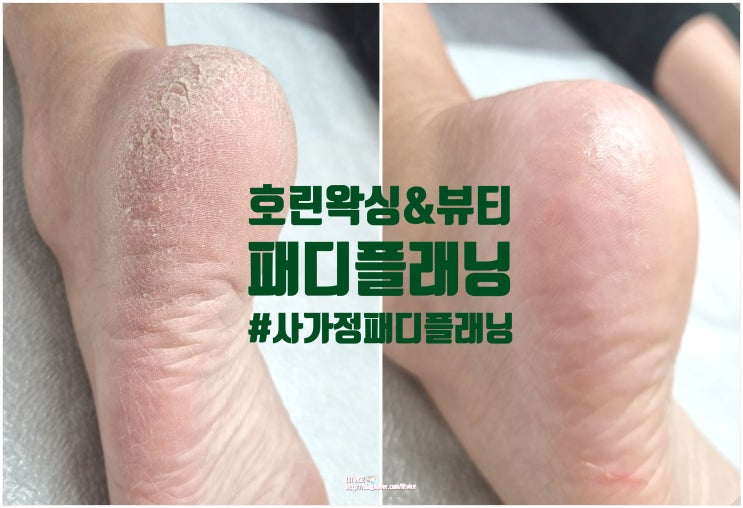 사가정패디플래닝 호린왁싱&뷰티 발뒤꿈치가 반짝반짝