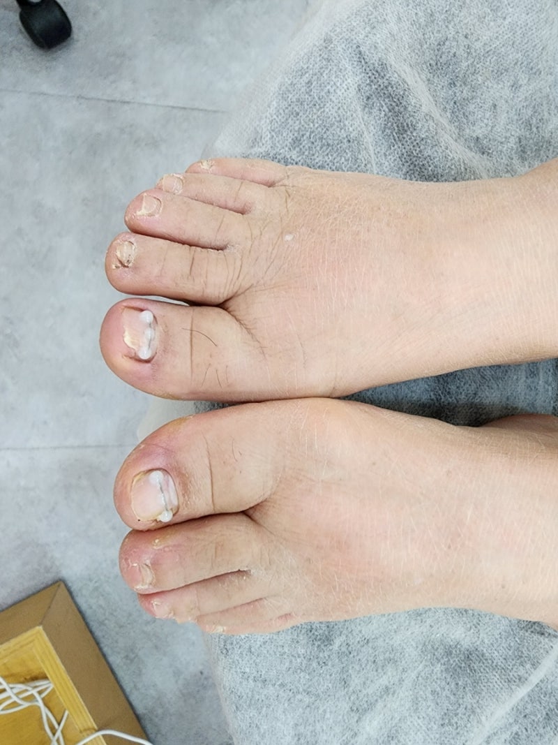 대체 왜 게임이 잘못된 정보를 퍼뜨리는 거야? 실제로 휘둘러 보면 매미 발톱이 카타나보다 확실히 느린데, 게임은 발톱이 한 포인트 더  빠르다고 주장하네. : r/cyberpunkgame, image size:800x1067