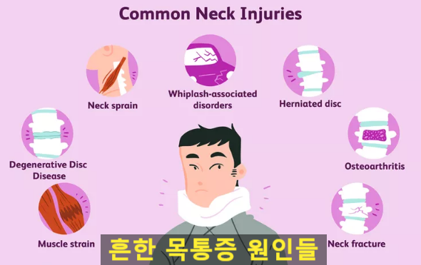  자고 일어났더니 목이 아파요. 목에 담이 걸렸을 때 통증 치료 (서면, 부전동)