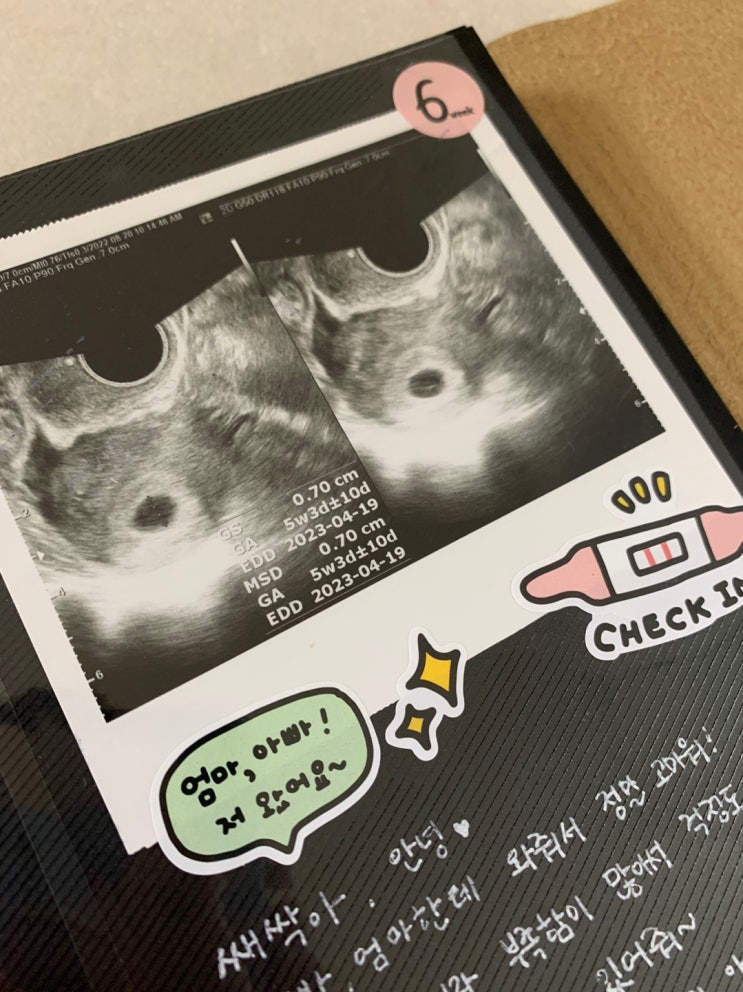 2. 아빠의 임신 다이어리 (일상유희 초음파앨범) 2. 아빠의 임신 다이어리 (일상유희 초음파앨범)