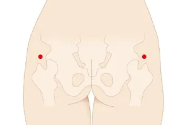  임산부 환도선다 어디가 어떻게 아픈 거죠?
