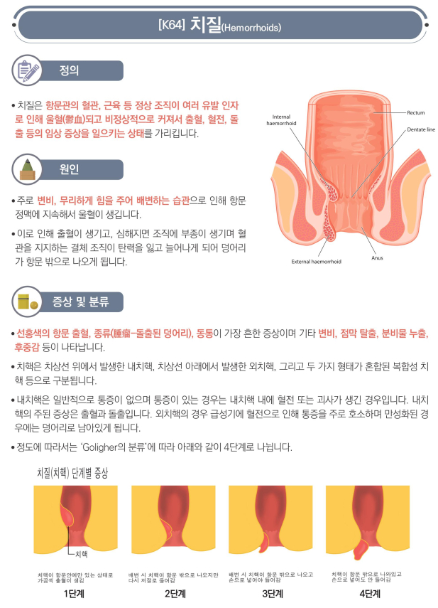  창원 치질, 항문거근증후군 한약과 침구치료로 해결하세요(비수술치료-환부노출x)