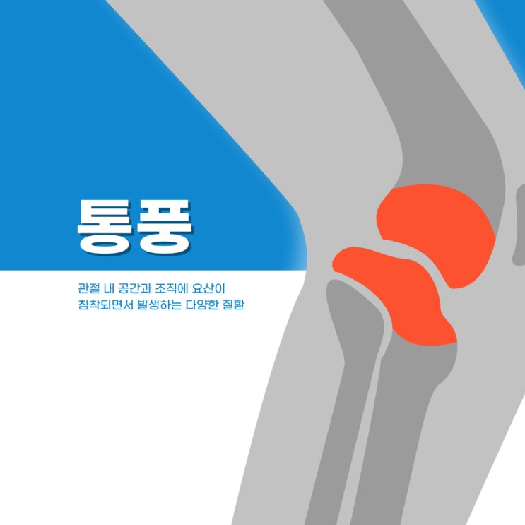  통증과 발작을 일으키는 통풍!