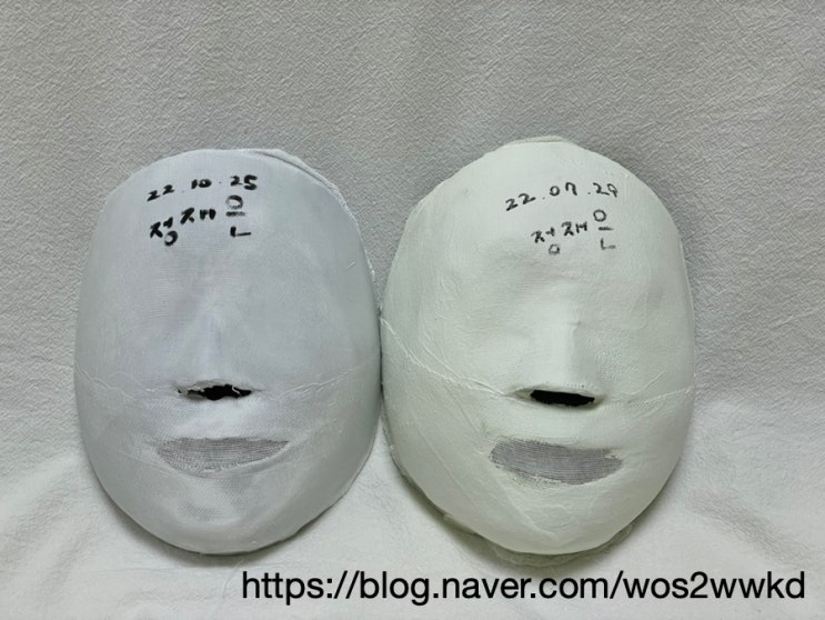  [약손명가 창원 메트로시티점] 작은 얼굴관리 & 동안 얼굴관리 10회차 석고 후기