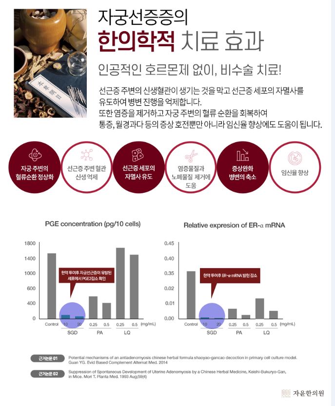  자궁선근증에 효과적인 치료법은? 자윤한의원 범계 산본