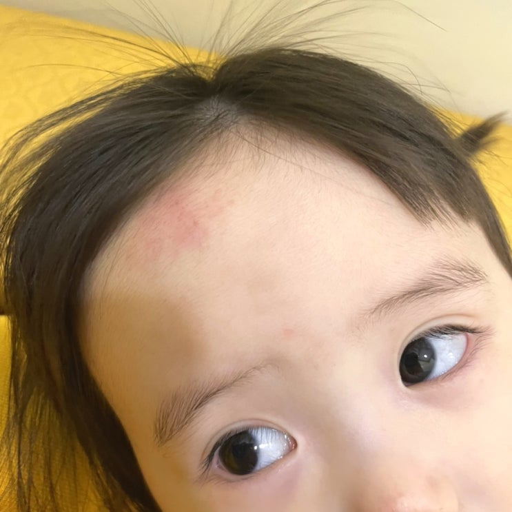  아기 낙상사고시 기억해야 할 것