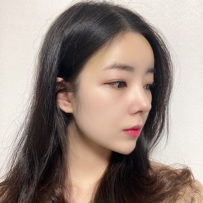  코지방이식 수술 대만족 후기(매부리코+이마지방이식)