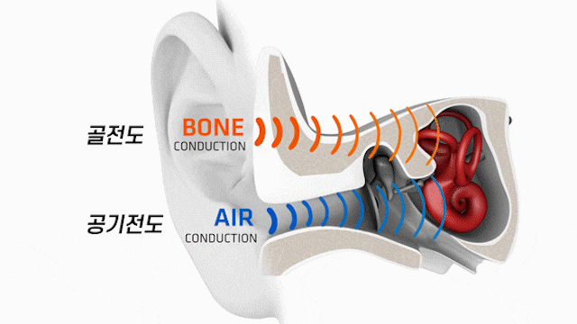 청력검사 해석하기! 청력도(audiogram) 읽는 방법