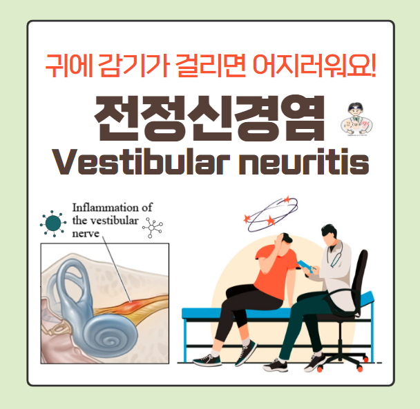  어지럼증(4) - 전정신경염(Vestibular neuritis) : 귀에 걸리는 감기, 감기에 걸리고 나서 어질어질해요!
