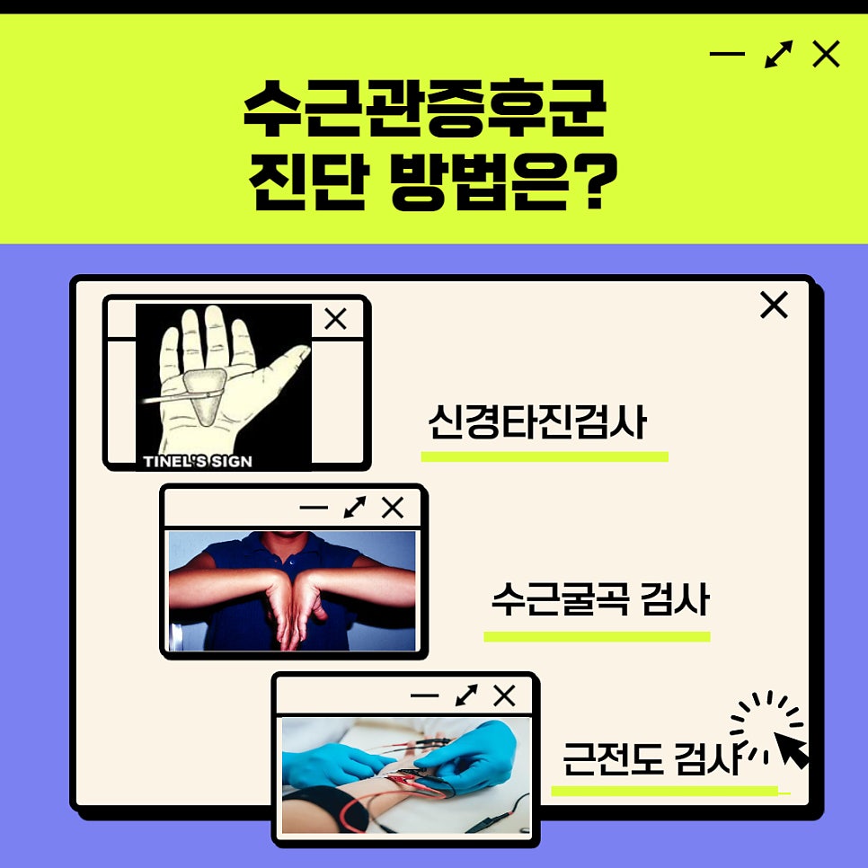손통증! 수근관증후군(손목터널증후군) — 본문 그림