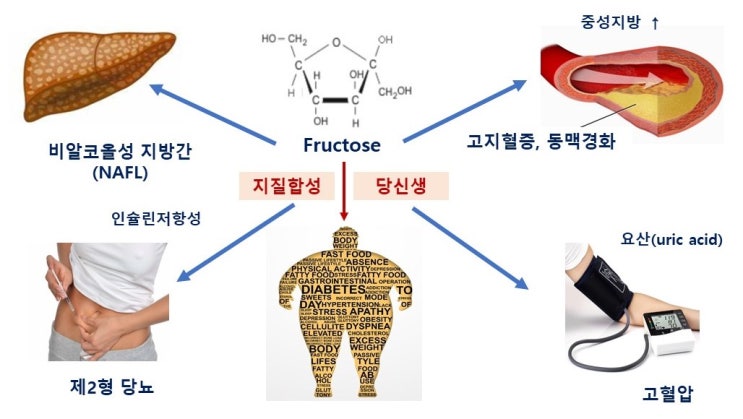  액상과당(고과당콘시럽, HFCS)과 비만, 식욕조절 장애