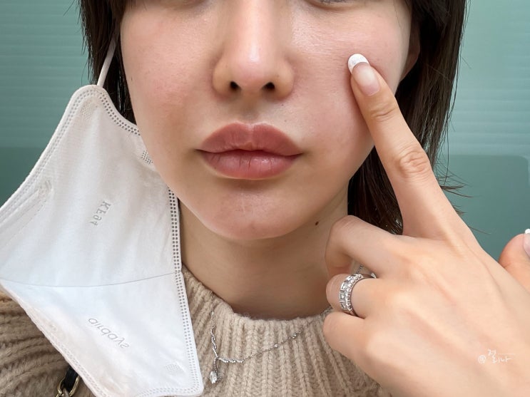  청담동 피부과 레이저 시술 추천. 티타늄리프팅 효과(가격/ 후기)