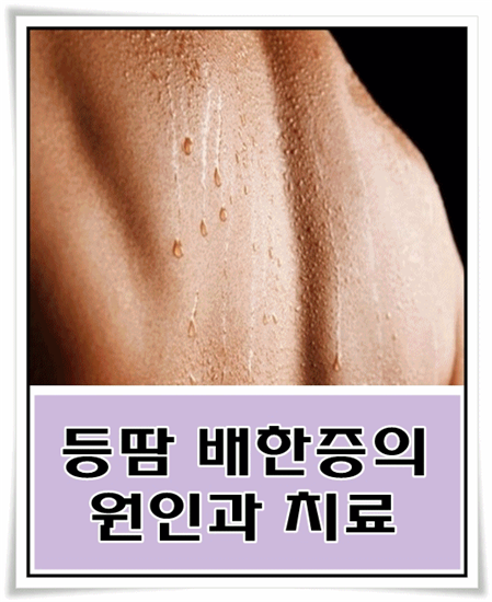 땀을 많이 흘리는 이유 - 다한증, 두한증, 수족다한증, 수족한증, 안면다한증