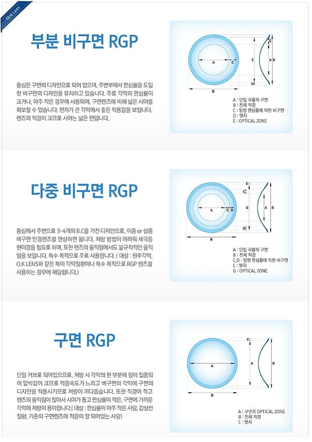 라식, 라섹수술 후 퇴행성 근시진행 - 안산 고잔동 하드렌즈 전문점