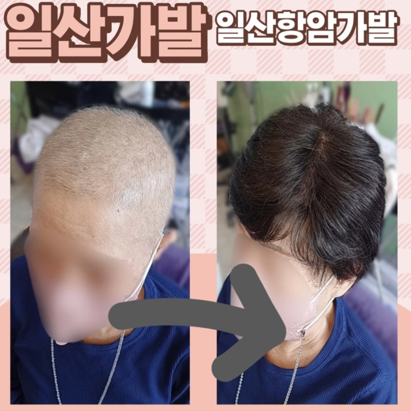 일산 여성가발 일산맞춤가발[띠앙모] 일산 남성가발 일산항암가발 4