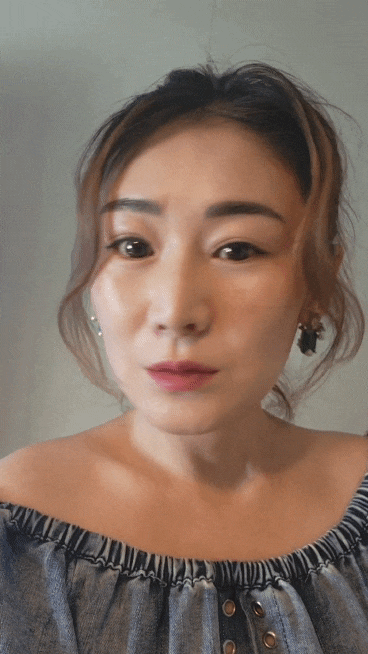  피부과 건성피부 관리 추천 리쥬란힐러+눈가주름 보톡스 물광주사 효과 주기 가격 통증 후기