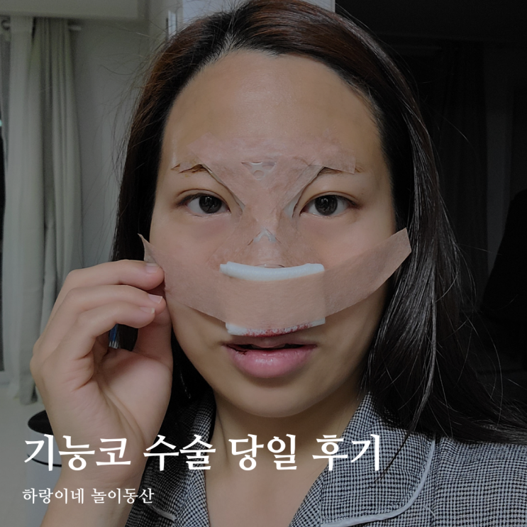  육아맘 비염 기능코 수술 당일 통증 후기