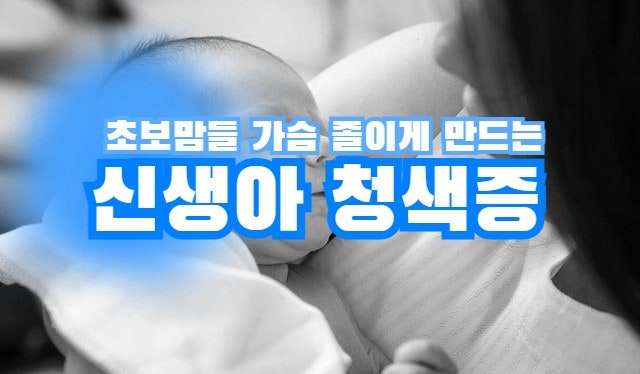 | 신생아 청색증 | 아기의 손가락, 발가락 끝이 푸른빛을 띌 때!