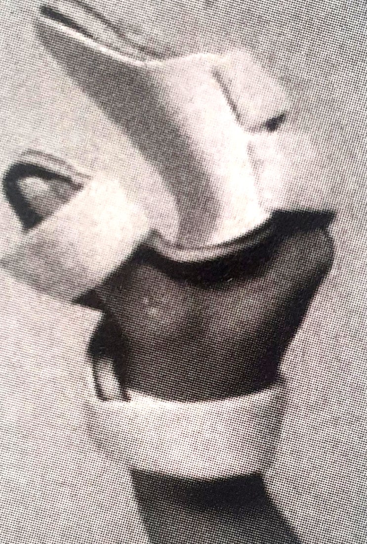  정중신경, 노신경, 자신경 마비 보조기 : 맞섬부목(Opponens splint), 콕업부목(Cock up splint), 너클밴드부목(Knuckle bender splint)