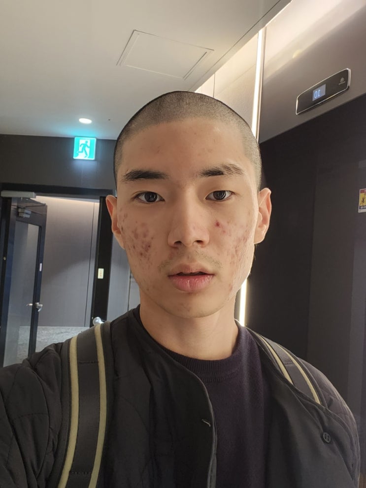  24세 공대생 남자, 피부 관리 시작하다.