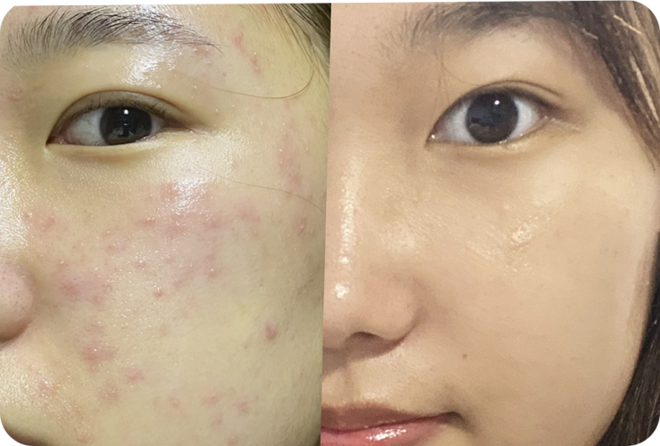  클렌징폼 추천 부담이 없어요!